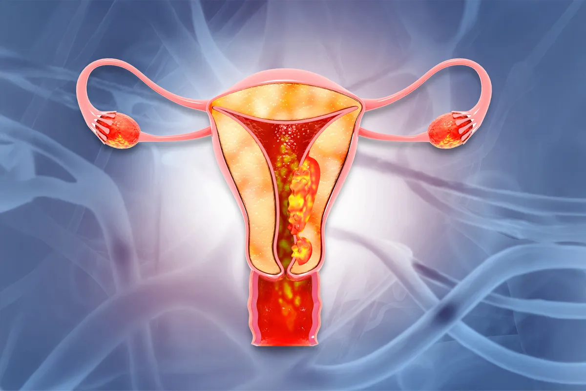 Screening cancer sân și col uterin după 40 de ani – ghid 2026 programe gratuite România + semne de alarmă